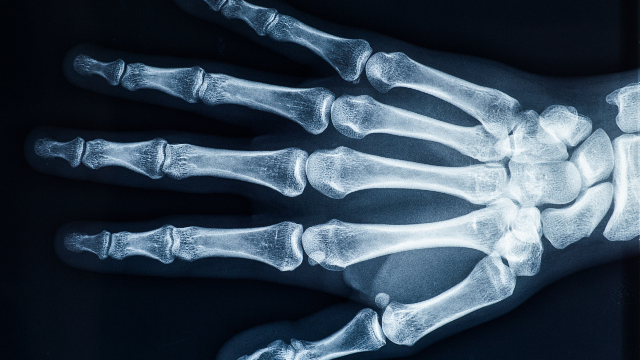Can Urgent Care Do X-rays? Yes — And here’s Why It Might Be Your Best Option
